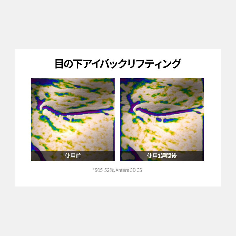 KAHI アイバーム